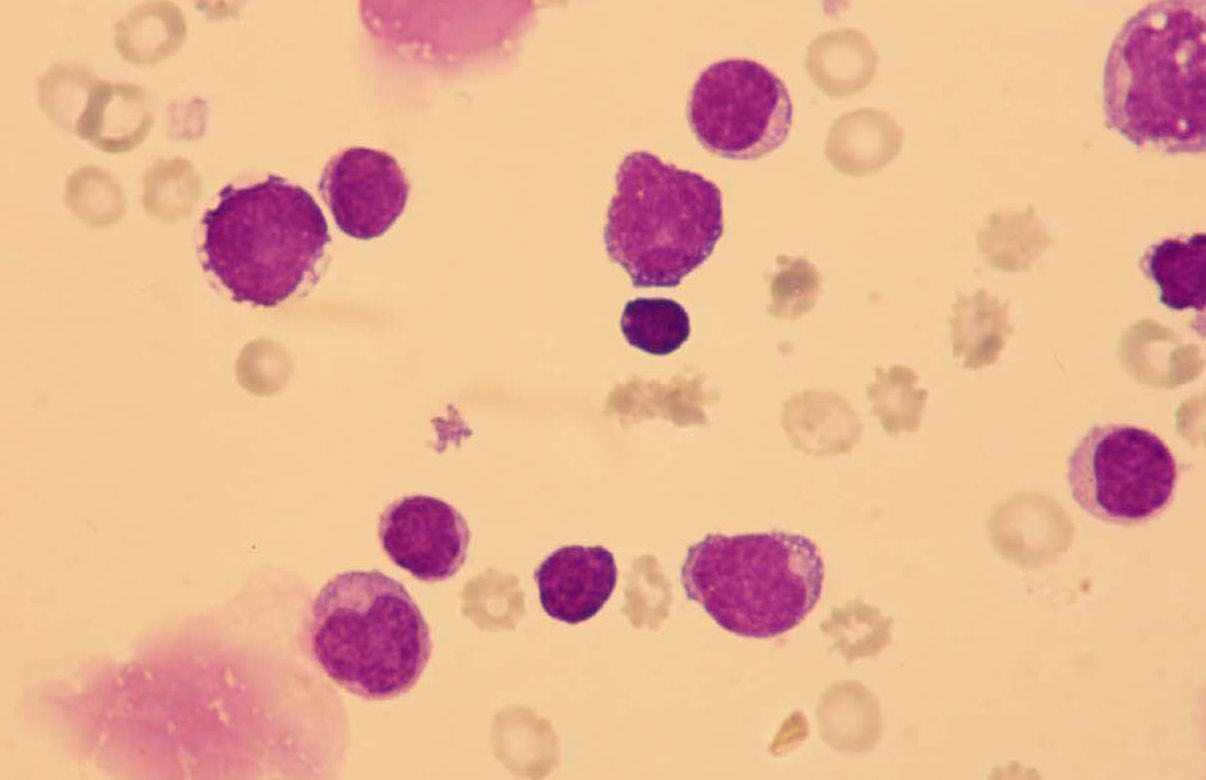 Lymphatische Zellen