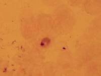 Abb41_PmalDTr_weib_Gam_thumbnail_thumbnail_ger.jpg