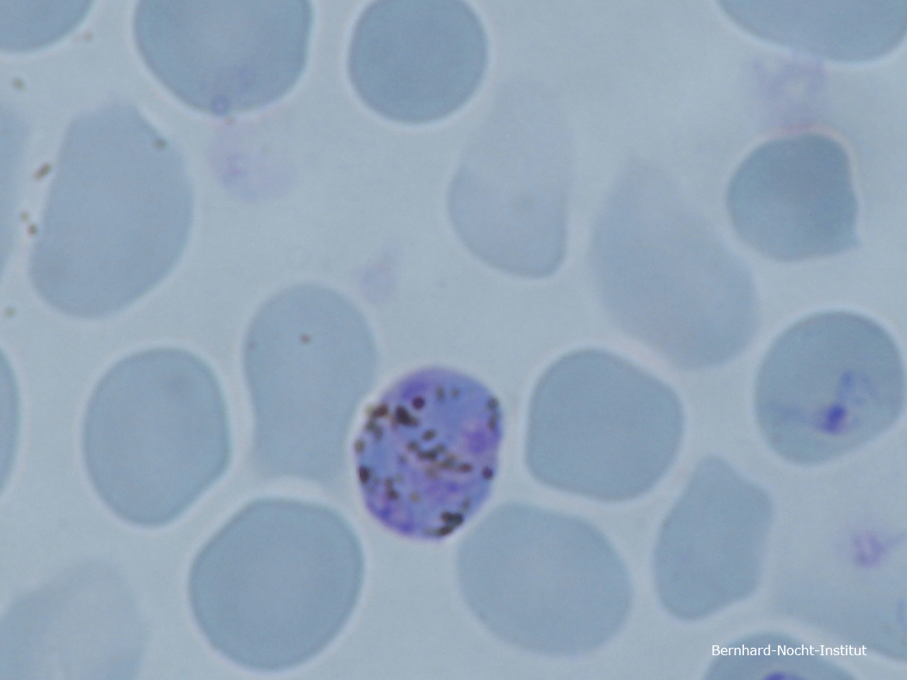 Plasmodium knowlesi (Blutausstriche, Kultur)