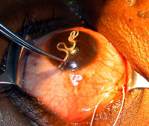 Medicine For Eye Infection In Dogs Medicine For Eye Infection In Dogs