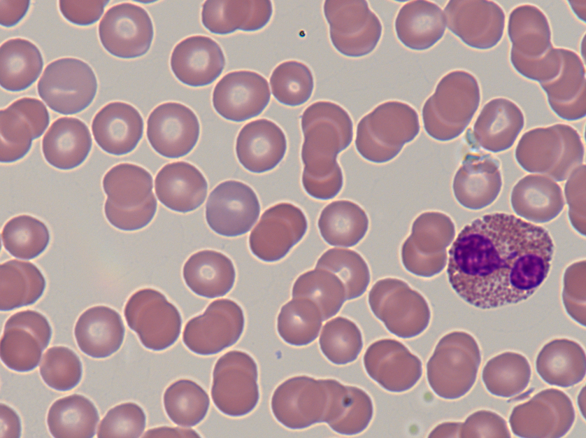 Eosinophile granulozyten